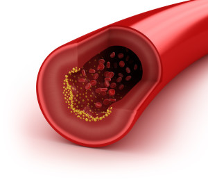 Cholesterol 1